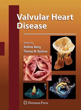 Wang / Bashore |  Valvular Heart Disease | Buch |  Sack Fachmedien