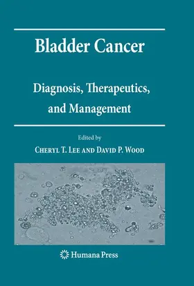 Lee / Wood |  Bladder Cancer | Buch |  Sack Fachmedien