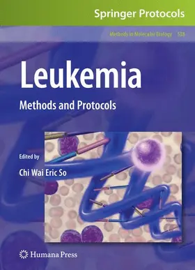 So |  Leukemia | Buch |  Sack Fachmedien