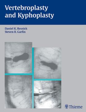 Resnick / Barr / Garfin | Vertebroplasty and Kyphoplasty | Buch | 978-1-58890-227-6 | sack.de