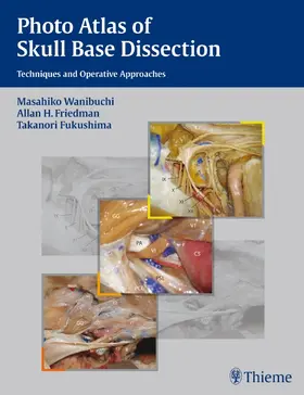 Wanibuchi / Friedman / Fukushima | Photo Atlas of Skull Base Dissection | Buch | 978-1-58890-521-5 | www.sack.de