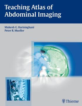 Harisinghani / Mueller | Teaching Atlas of Abdominal Imaging | E-Book | sack.de