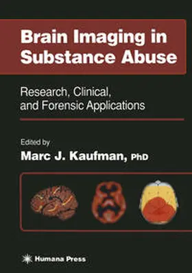 Kaufman |  Brain Imaging in Substance Abuse | eBook | Sack Fachmedien