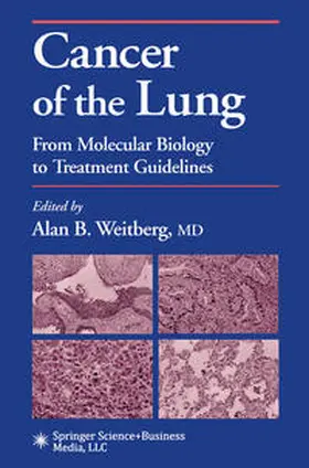 Weitberg | Cancer of the Lung | E-Book | www.sack.de