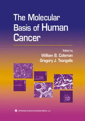 Coleman / Tsongalis | The Molecular Basis of Human Cancer | E-Book | sack.de