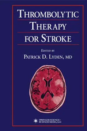 Lyden |  Thrombolytic Therapy for Stroke | eBook | Sack Fachmedien