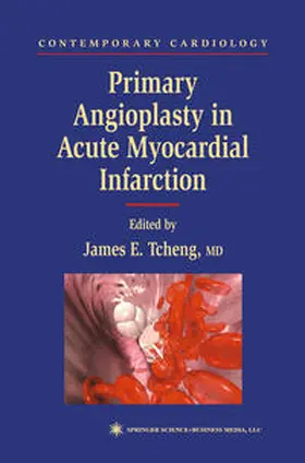 Tcheng |  Primary Angioplasty in Acute Myocardial Infarction | eBook | Sack Fachmedien