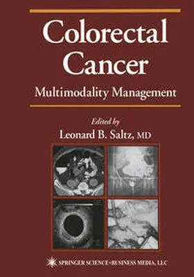 Saltz |  Colorectal Cancer | eBook | Sack Fachmedien