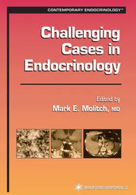 Molitch |  Challenging Cases in Endocrinology | eBook | Sack Fachmedien