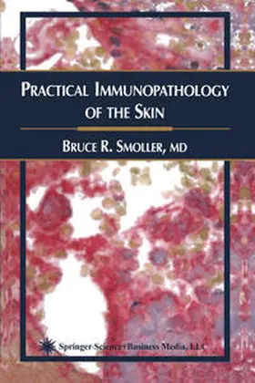 Smoller | Practical Immunopathology of the Skin | E-Book | www.sack.de