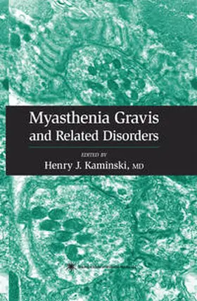 Kaminski |  Myasthenia Gravis and Related Disorders | eBook | Sack Fachmedien