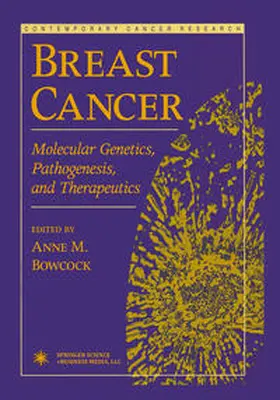 Bowcock |  Breast Cancer | eBook | Sack Fachmedien