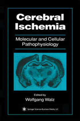 Walz | Cerebral Ischemia | E-Book | sack.de
