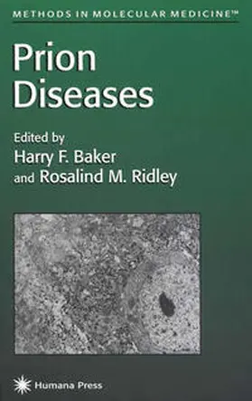 Baker / Ridley |  Prion Diseases | eBook | Sack Fachmedien