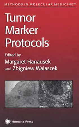 Hanausek / Walaszek |  Tumor Marker Protocols | eBook | Sack Fachmedien