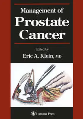 Klein |  Management of Prostate Cancer | eBook | Sack Fachmedien