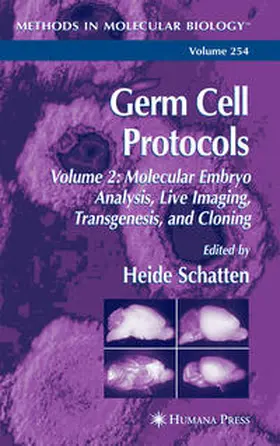 Schatten |  Germ Cell Protocols | eBook | Sack Fachmedien