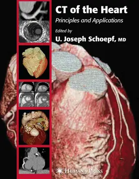 Schoepf |  CT of the Heart | eBook | Sack Fachmedien
