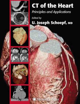 Schoepf | CT of the Heart | E-Book | sack.de
