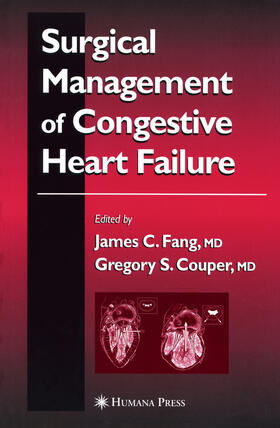 Fang / Couper |  Surgical Management of Congestive Heart Failure | eBook | Sack Fachmedien