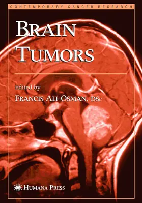 Ali-Osman |  Brain Tumors | eBook | Sack Fachmedien
