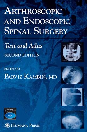Kambin | Arthroscopic and Endoscopic Spinal Surgery | E-Book | sack.de