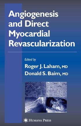 Laham / Baim |  Angiogenesis and Direct Myocardial Revascularization | eBook | Sack Fachmedien