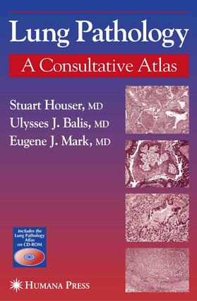 Houser / Mark / Balis | Lung Pathology | E-Book | sack.de