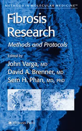 Varga / Brenner / Phan |  Fibrosis Research | eBook | Sack Fachmedien