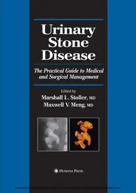 Stoller / Meng |  Urinary Stone Disease | eBook | Sack Fachmedien