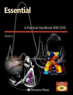Solomon | Essential Echocardiography | E-Book | www.sack.de