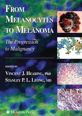 Hearing / Leong | From Melanocytes to Melanoma | E-Book | www.sack.de