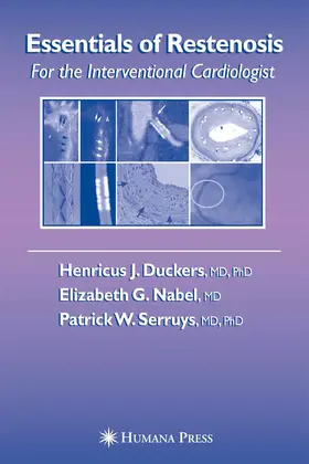 Essentials of Restenosis | E-Book | www.sack.de