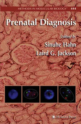 Hahn / Jackson | Prenatal Diagnosis | E-Book | www.sack.de