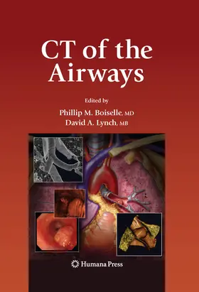 Boiselle / Lynch |  CT of the Airways | eBook | Sack Fachmedien