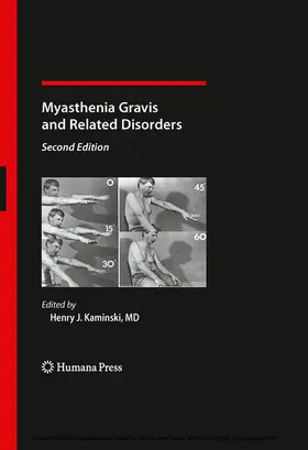 Kaminski |  Myasthenia Gravis and Related Disorders | eBook | Sack Fachmedien