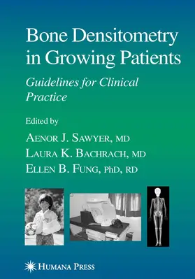 Sawyer |  Bone Densitometry in Growing Patients | eBook | Sack Fachmedien