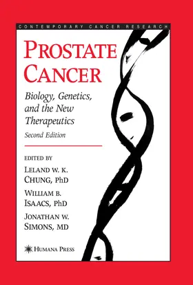 Chung / Isaacs / Simons | Prostate Cancer | E-Book | www.sack.de