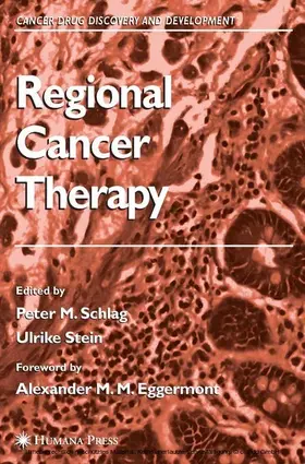Schlag / Stein | Regional Cancer Therapy | E-Book | www.sack.de