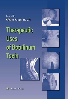 Cooper |  Therapeutic Uses of Botulinum Toxin | eBook | Sack Fachmedien