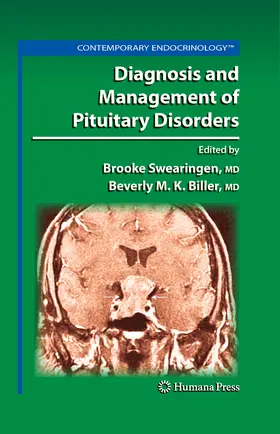 Swearingen / Biller | Diagnosis and Management of Pituitary Disorders | E-Book | sack.de