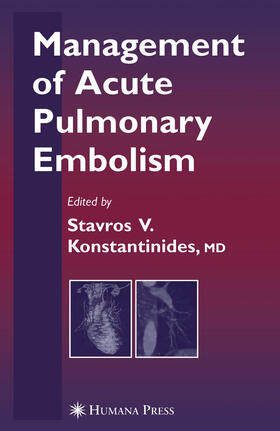 Konstantinides |  Management of Acute Pulmonary Embolism | eBook | Sack Fachmedien