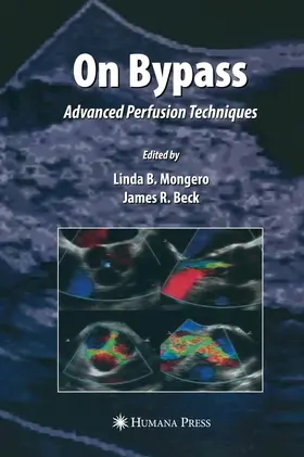 Mongero / Beck |  On Bypass | eBook | Sack Fachmedien