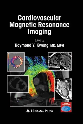 Kwong | Cardiovascular Magnetic Resonance Imaging | E-Book | www.sack.de