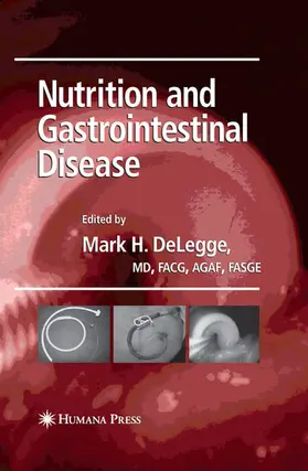 Delegge |  Nutrition and Gastrointestinal Disease | eBook | Sack Fachmedien