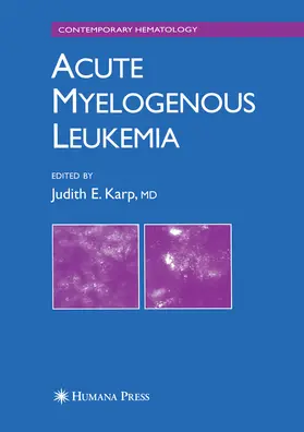 Karp | Acute Myelogenous Leukemia | E-Book | www.sack.de