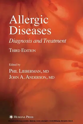 Lieberman / Anderson |  Allergic Diseases | eBook | Sack Fachmedien