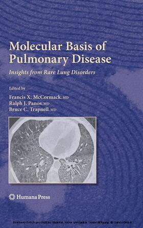 McCormack / Panos / Trapnell | Molecular Basis of Pulmonary Disease | E-Book | sack.de