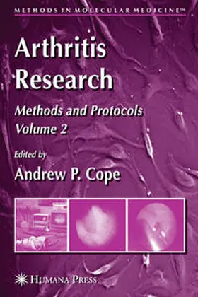 Cope |  Arthritis Research | eBook | Sack Fachmedien