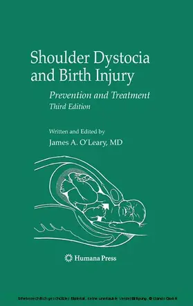 O'Leary |  Shoulder Dystocia and Birth Injury | eBook | Sack Fachmedien